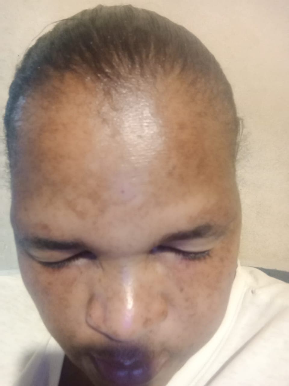 first image